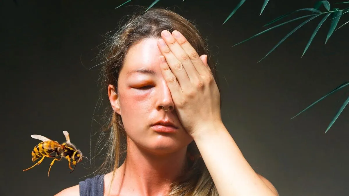 Bras avec rougeur localisée après piqûre d'insecte en extérieur