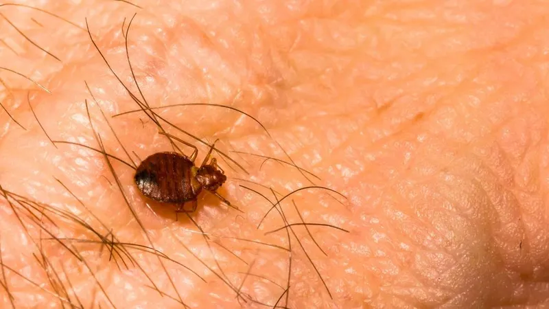 Bras avec trois boutons rouges alignés caractéristiques d'une piqûre de punaise de lit