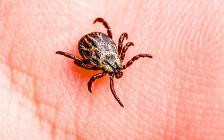 Tique adulte Ixodes ricinus posée sur une feuille de chêne avec une main et un tire-tique en plastique blanc en arrière-plan flou